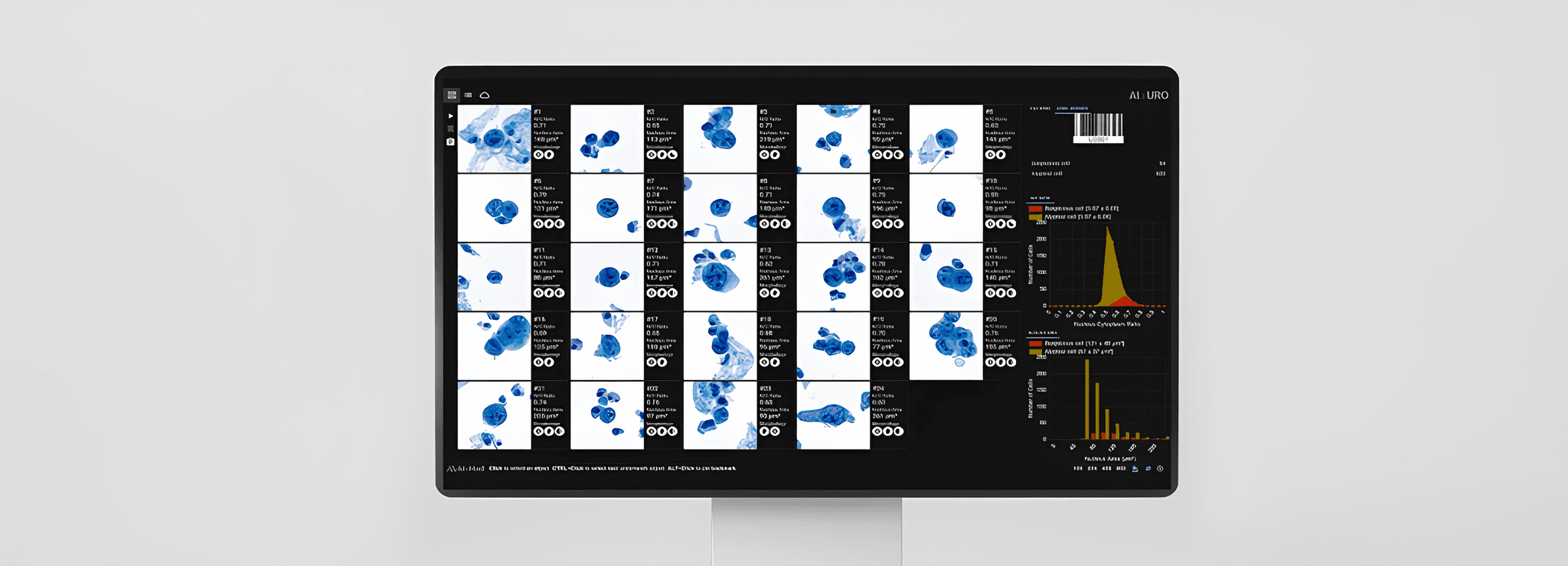 AIxURO software interface for urinary cytology research