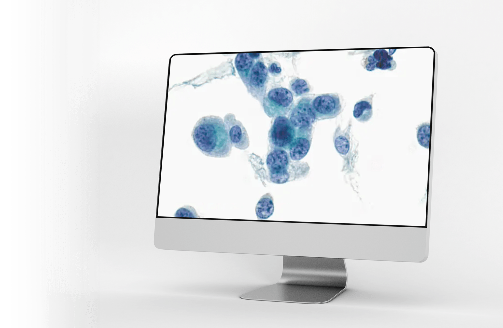 AIxURO urinary cytology