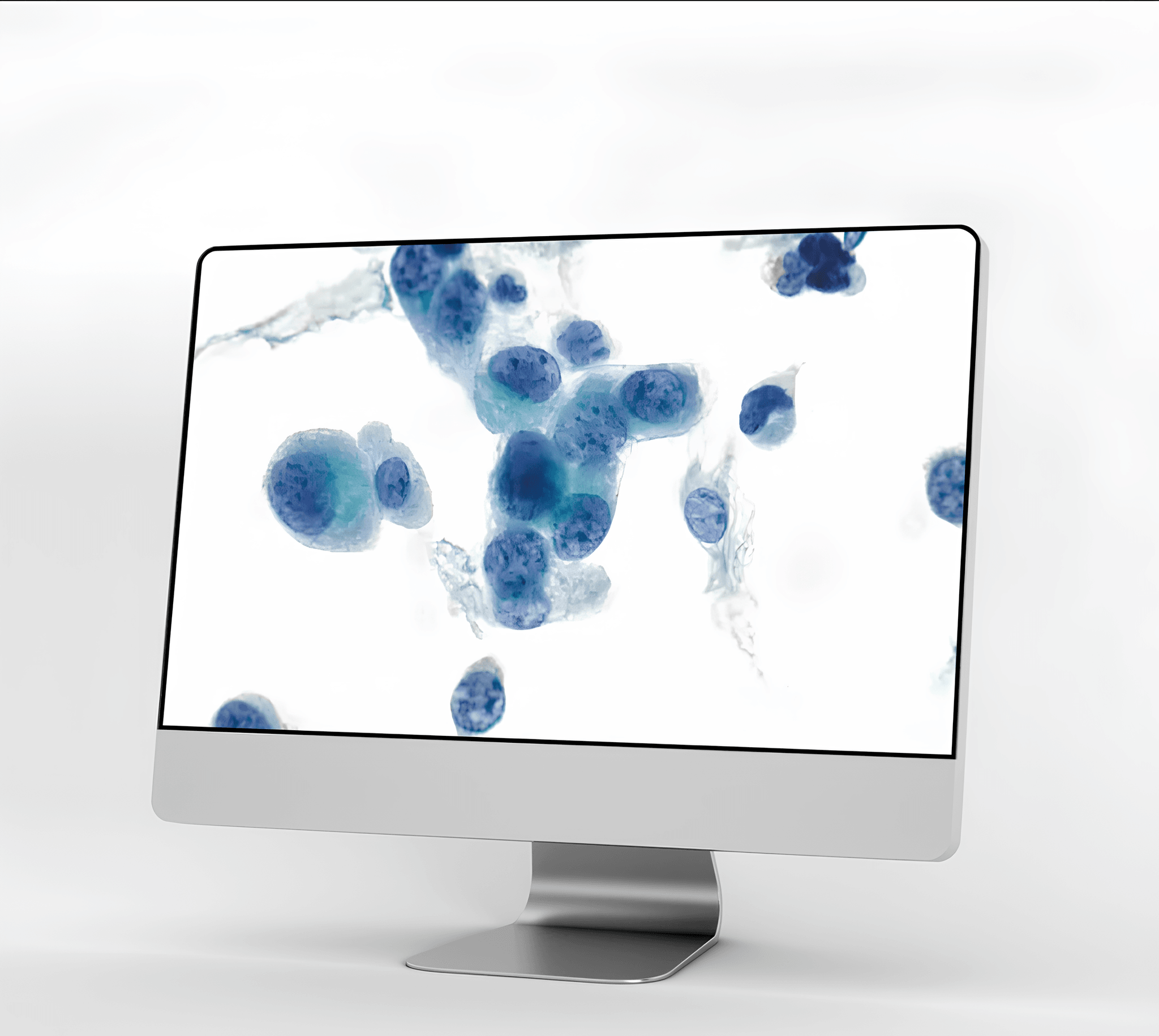 AIxURO urinary cytology