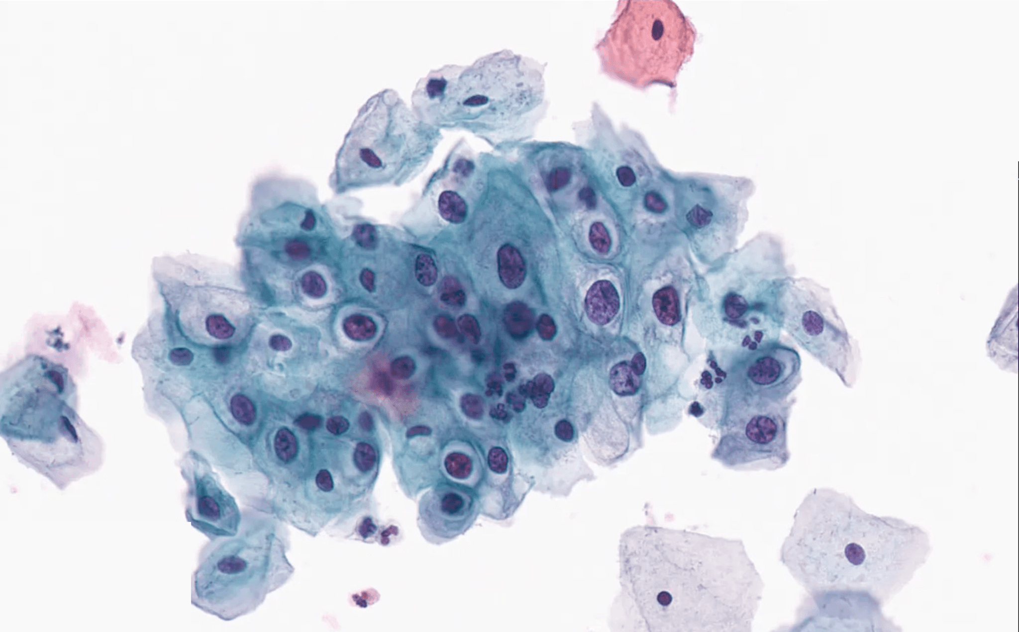 Cervical cytology microscopy