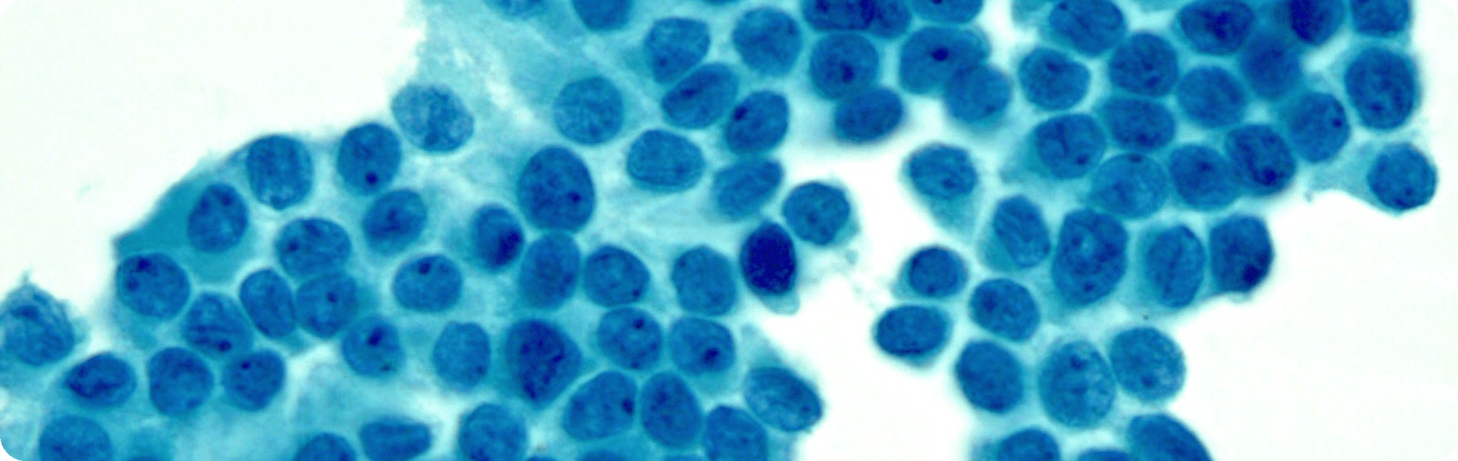 Thyroid cytology microscopy