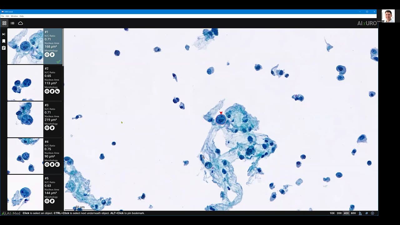 AIxMed: See AIxURO in Action